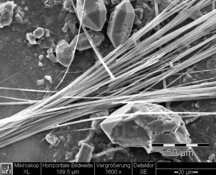 Image prise par un MEB du tremolite dans les crépis - Résolution standard 654 x 522 px / taille du fichier env. 0,35 Mo | © CRB Analyse Service GmbH